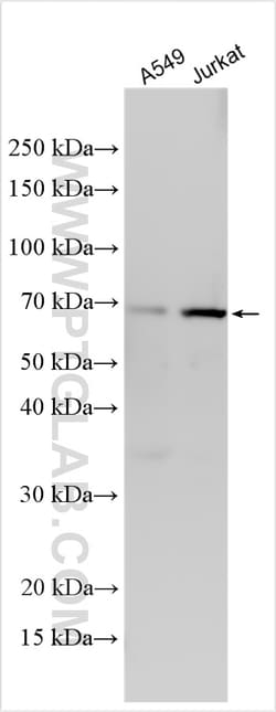 ACTR8 Rabbit Polyclonal Antibody, Proteintech:Antibodies:Primary Antibodies