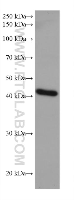 ADA Mouse Monoclonal Antibody, Proteintech 20 &mu;L | Buy Online | Proteintech | Fisher Scientific