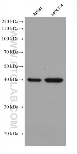 ADA Mouse Monoclonal Antibody, Proteintech 20 &mu;L | Buy Online | Proteintech | Fisher Scientific