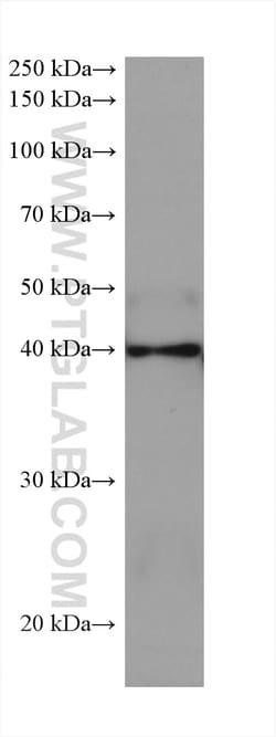 ADA Mouse Monoclonal Antibody, Proteintech 20 &mu;L | Buy Online | Proteintech | Fisher Scientific