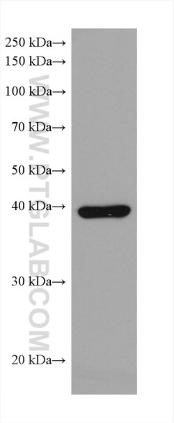 ADA Mouse Monoclonal Antibody, Proteintech 20 &mu;L | Buy Online | Proteintech | Fisher Scientific