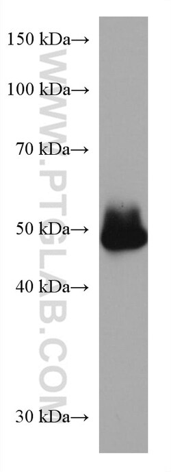 ADC Mouse Monoclonal Antibody, Proteintech:Antibodies:Primary Antibodies