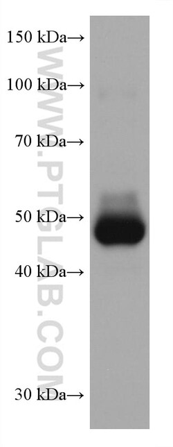 ADC Mouse Monoclonal Antibody, Proteintech:Antibodies:Primary Antibodies