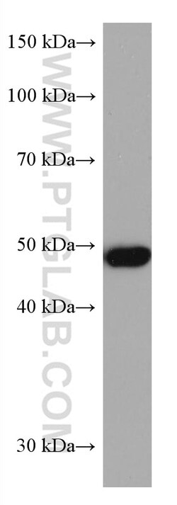 ADC Mouse Monoclonal Antibody, Proteintech:Antibodies:Primary Antibodies
