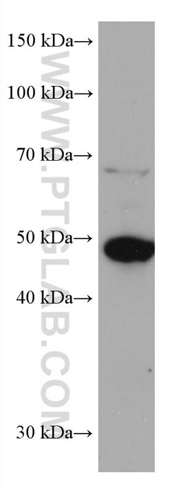 ADC Mouse Monoclonal Antibody, Proteintech:Antibodies:Primary Antibodies