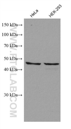ADC Mouse Monoclonal Antibody, Proteintech:Antibodies:Primary Antibodies