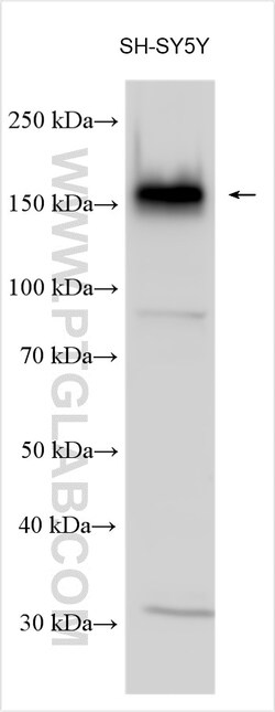 ADCY8 Rabbit Polyclonal Antibody, Proteintech:Antibodies:Primary Antibodies