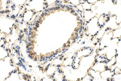 ADRB1 Rabbit Polyclonal Antibody, Proteintech:Antibodies:Primary Antibodies