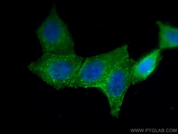 AGT Mouse Monoclonal Antibody, Proteintech:Antibodies:Primary Antibodies