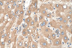 AGT Mouse Monoclonal Antibody, Proteintech:Antibodies:Primary Antibodies
