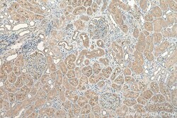 AGT Mouse Monoclonal Antibody, Proteintech:Antibodies:Primary Antibodies