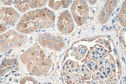 AGT Mouse Monoclonal Antibody, Proteintech:Antibodies:Primary Antibodies