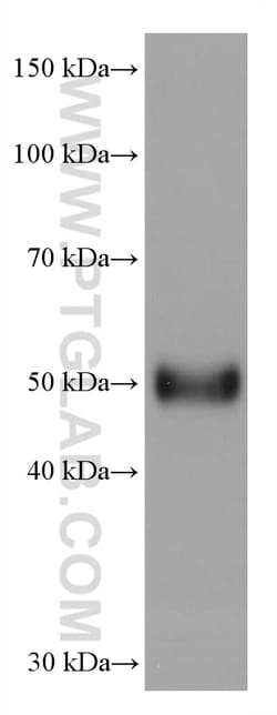AGT Mouse Monoclonal Antibody, Proteintech:Antibodies:Primary Antibodies