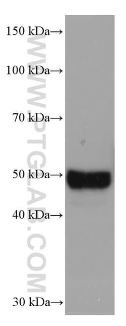 AGT Mouse Monoclonal Antibody, Proteintech:Antibodies:Primary Antibodies