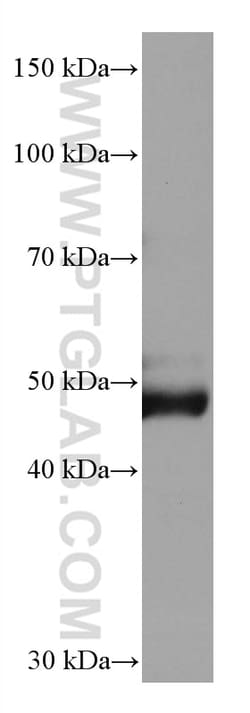 AGT Mouse Monoclonal Antibody, Proteintech:Antibodies:Primary Antibodies