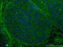 AHR Mouse Monoclonal Antibody, Proteintech:Antikörper:Primärantikörper