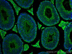 AHR Mouse Monoclonal Antibody, Proteintech:Antikörper:Primärantikörper
