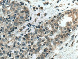 AHR Mouse Monoclonal Antibody, Proteintech:Antikörper:Primärantikörper