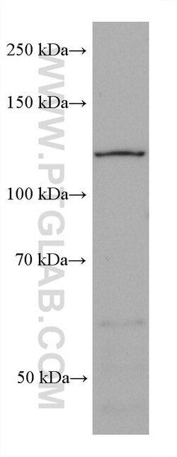 AHR Mouse Monoclonal Antibody, Proteintech:Antikörper:Primärantikörper