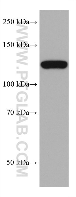 AHR Mouse Monoclonal Antibody, Proteintech:Antikörper:Primärantikörper