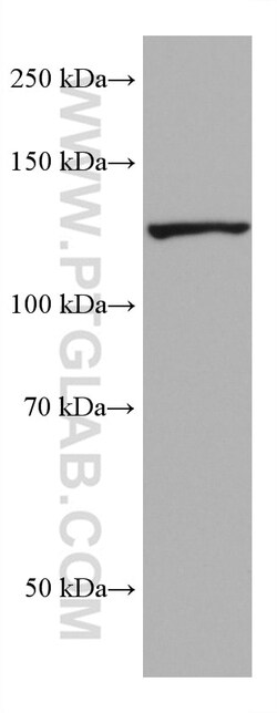 AHR Mouse Monoclonal Antibody, Proteintech:Antikörper:Primärantikörper