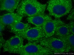 AIDA Mouse Monoclonal Antibody, Proteintech:Antibodies:Primary Antibodies