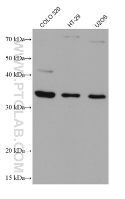 AIDA Mouse Monoclonal Antibody, Proteintech:Antibodies:Primary Antibodies