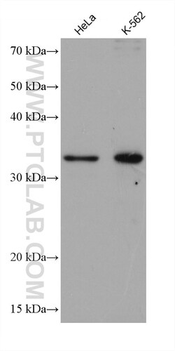 AIDA Mouse Monoclonal Antibody, Proteintech:Antibodies:Primary Antibodies