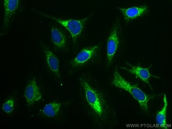 AIF Mouse Monoclonal Antibody, Proteintech:Antibodies:Primary Antibodies