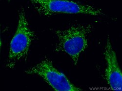 AIF Mouse Monoclonal Antibody, Proteintech:Antibodies:Primary Antibodies