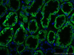 AIF Mouse Monoclonal Antibody, Proteintech:Antibodies:Primary Antibodies