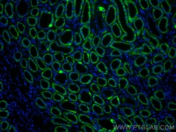 AIF Mouse Monoclonal Antibody, Proteintech:Antibodies:Primary Antibodies