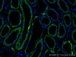 AIF Mouse Monoclonal Antibody, Proteintech:Antibodies:Primary Antibodies