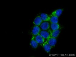 AIF Mouse Monoclonal Antibody, Proteintech:Antibodies:Primary Antibodies