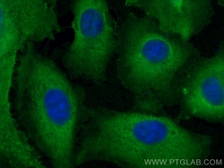 AKR1B10 Mouse Monoclonal Antibody, Proteintech:Antibodies:Primary Antibodies