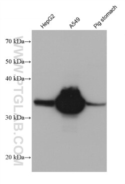 AKR1B10 Mouse Monoclonal Antibody, Proteintech:Antibodies:Primary Antibodies