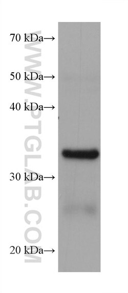 AKR1B10 Mouse Monoclonal Antibody, Proteintech:Antibodies:Primary Antibodies
