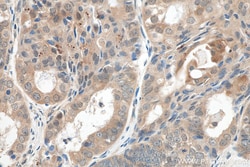 AKT1-Specific Rabbit Recombinant Antibody, Proteintech:Antibodies:Primary