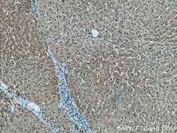 AKT2 Rabbit Polyclonal Antibody, Proteintech Unconjugated; 20 &mu;L:Antibodies,