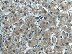 AKT2 Rabbit Polyclonal Antibody, Proteintech Unconjugated; 20 &mu;L:Antibodies,