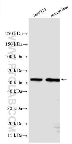 AKT2 Rabbit Polyclonal Antibody, Proteintech Unconjugated; 20 &mu;L:Antibodies,