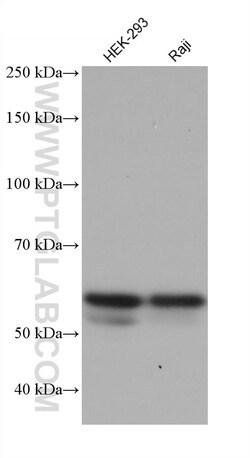ALAS2 Mouse Monoclonal Antibody, Proteintech:Antibodies:Primary Antibodies