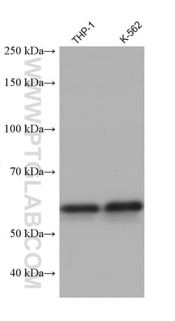 ALAS2 Mouse Monoclonal Antibody, Proteintech:Antibodies:Primary Antibodies
