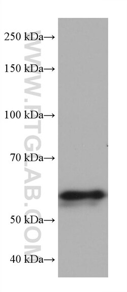 ALAS2 Mouse Monoclonal Antibody, Proteintech:Antibodies:Primary Antibodies