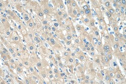 ALDH1A3 Rabbit Polyclonal Antibody, Proteintech:Antibodies:Primary Antibodies