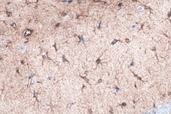 ALDH1L1 Mouse Monoclonal Antibody, Proteintech:Antibodies:Primary Antibodies