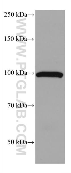 ALDH1L1 Mouse Monoclonal Antibody, Proteintech:Antibodies:Primary Antibodies