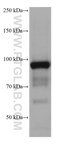 ALDH1L1 Mouse Monoclonal Antibody, Proteintech:Antibodies:Primary Antibodies