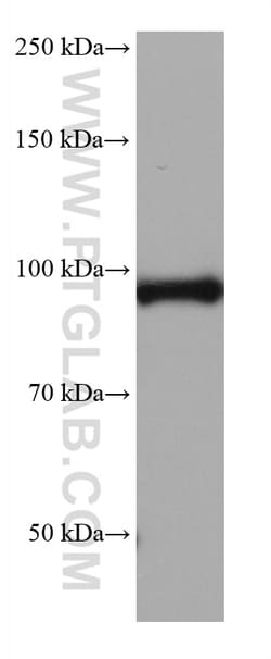 ALDH1L1 Mouse Monoclonal Antibody, Proteintech:Antibodies:Primary Antibodies