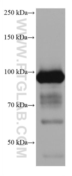 ALDH1L1 Mouse Monoclonal Antibody, Proteintech:Antibodies:Primary Antibodies